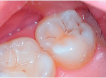 Item:Cure-dents — Wikidebrouillard