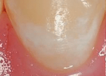 Item:Cure-dent — Wikidebrouillard